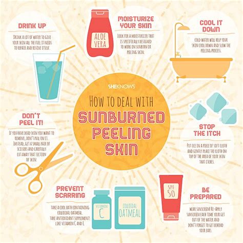 Should I ice a sunburn?