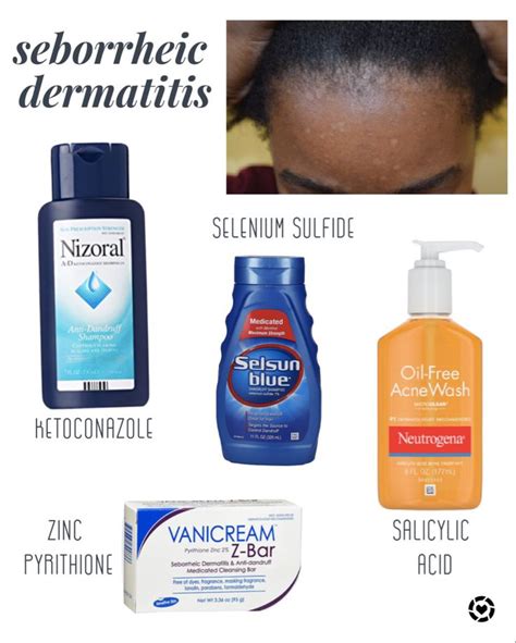 Should I moisturize my face if I have seborrheic dermatitis?