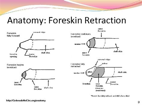 Should I pull my foreskin back after frenuloplasty?