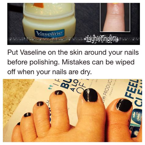 Should I put Vaseline on exposed nail bed?