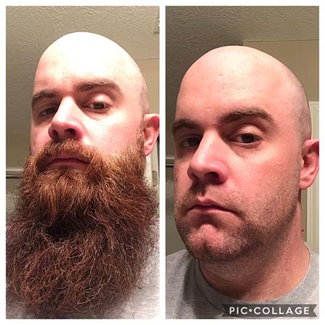Should I shave my beard after 3 months?