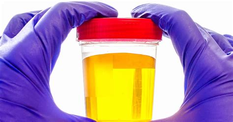 Should I stop taking vitamin B if urine is yellow?