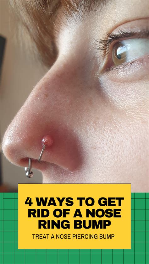 Should I take out my piercing if I have a bump?