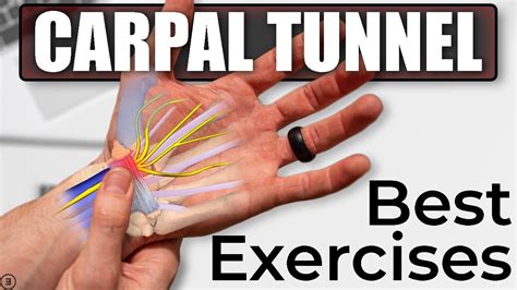 Should I workout with carpal tunnel?