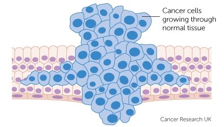 Should I worry about cancer at 20?