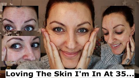 Should a 34 year old have wrinkles?