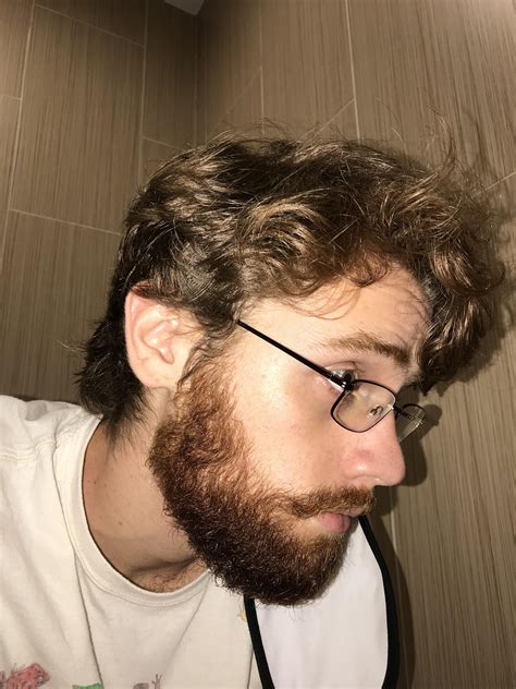 Should an 18 year old have a beard?