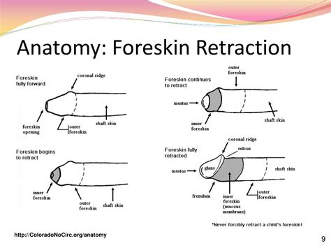 Should foreskin be connected to head?