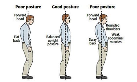 Should you always stand straight?