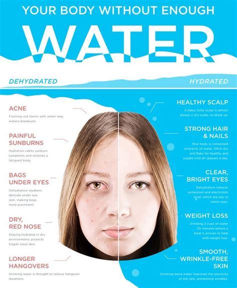Should you drink lots of water before Botox?