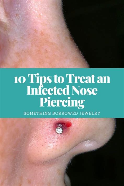 Should you leave an infected piercing alone?