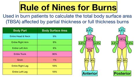 What's the difference between the rule of 9's and Lund and browder for calculating TBSA of burns?