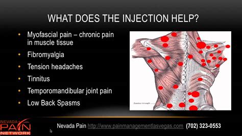 What's the most painful injection?