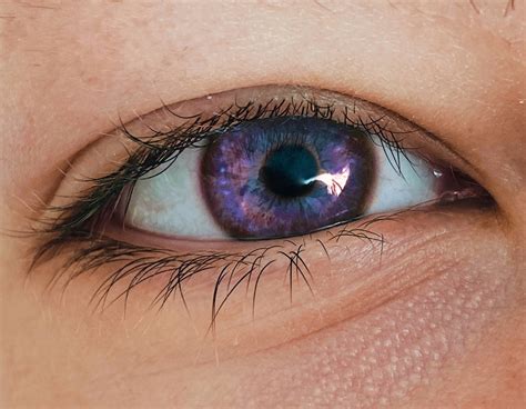 What's the rarest eye colour?