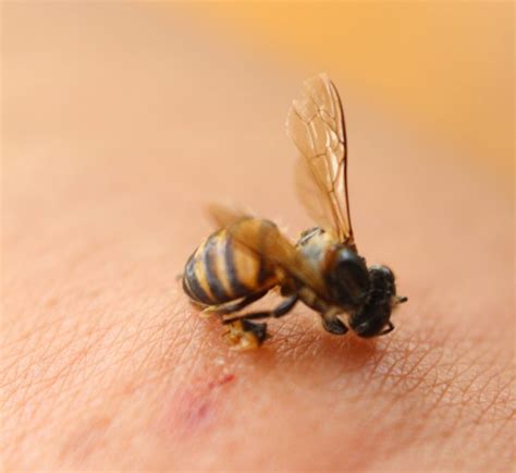 What's the worst place to get stung by a bee?
