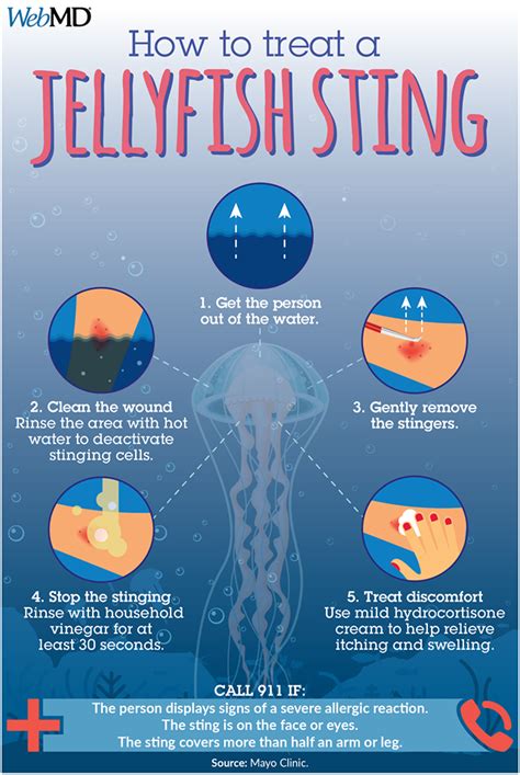 What's worse a jellyfish or stingray?