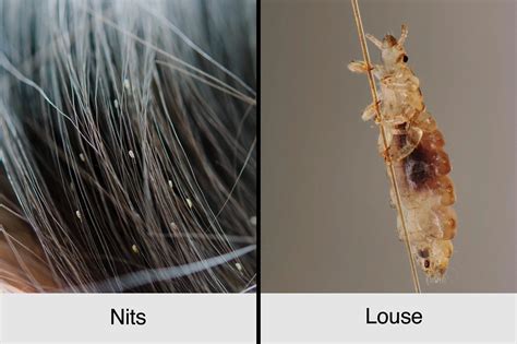 What's worse fleas or lice?