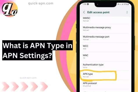 What APN type is best?