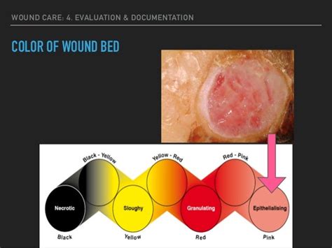 What Colour is a healthy wound?