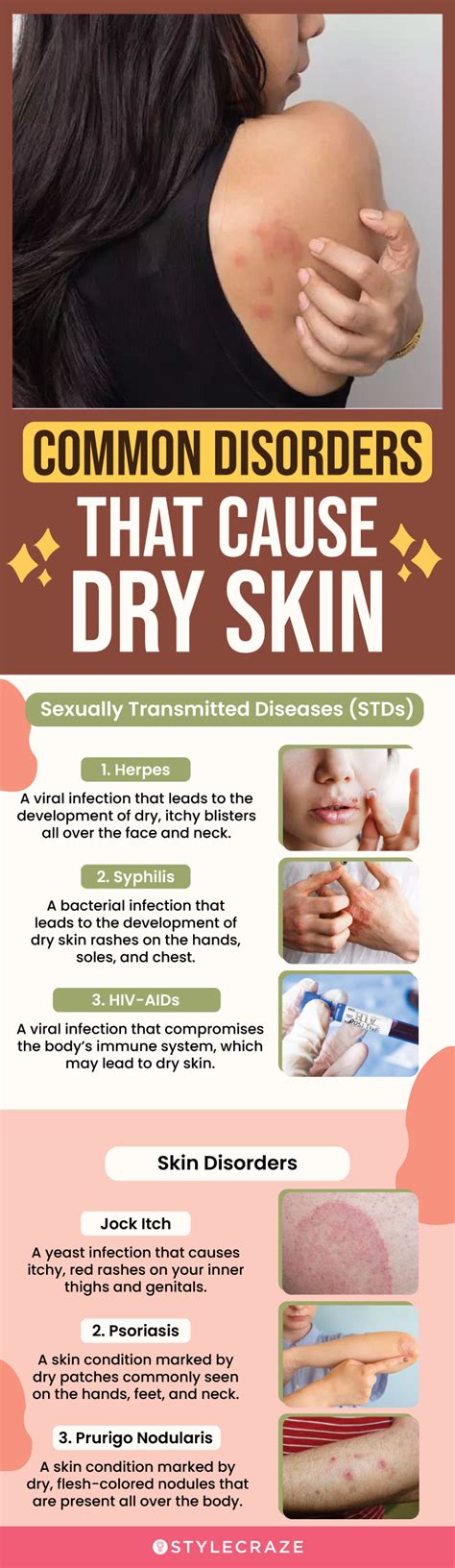 What STD causes dryness?