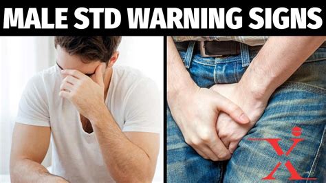What STD makes you feel sick and tired?