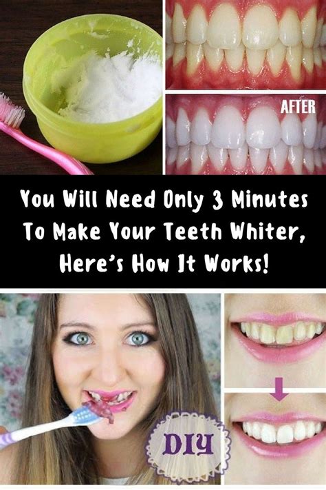 What actually makes your teeth whiter?