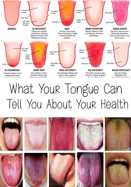 What affects tongue length?