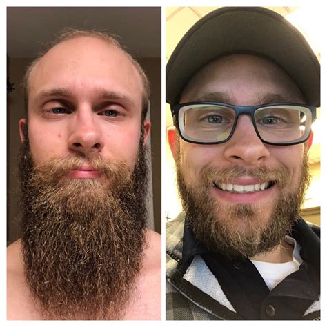 What age is a full beard?