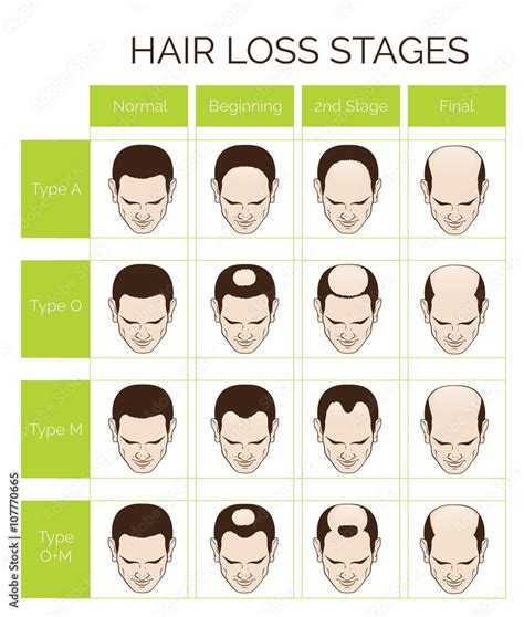 What age is hair loss the worst?