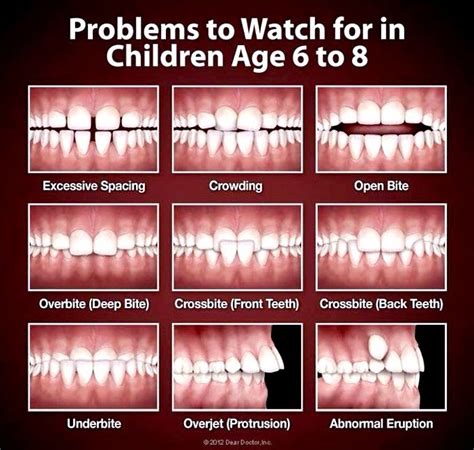 What age shouldn't you get braces?