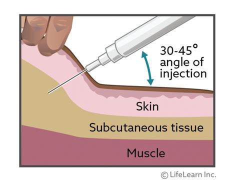 What angle is a subcutaneous injection on a dog?