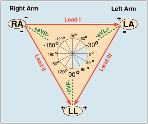 What angle is lead 3?