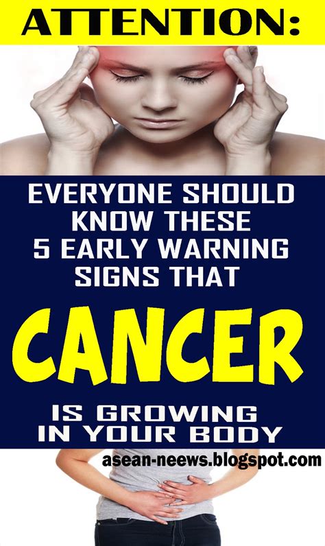 What are 10 signs of cancer you shouldn't ignore?