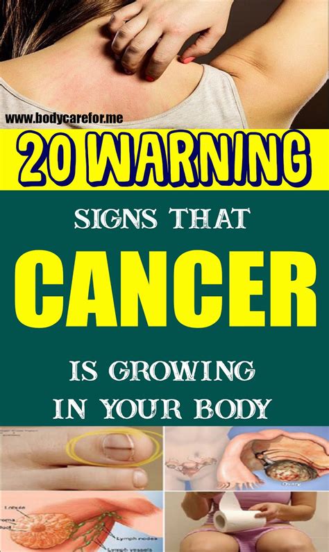 What are 20 warning signs of cancer?