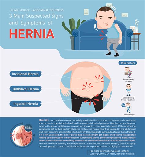 What are 3 signs you might have a hernia?