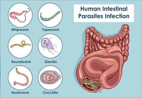 What are 3 symptoms of a parasite infection?
