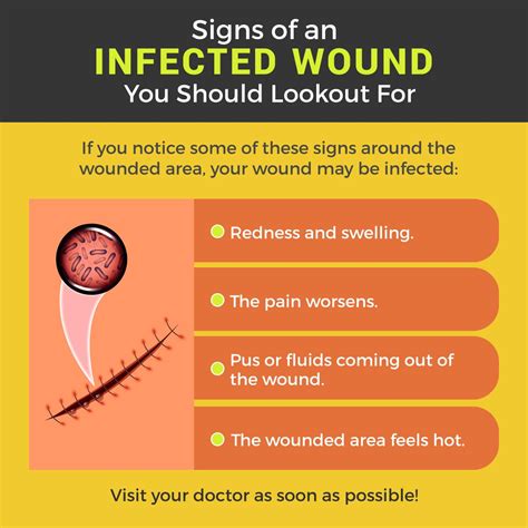 What are 4 signs a wound is infected?