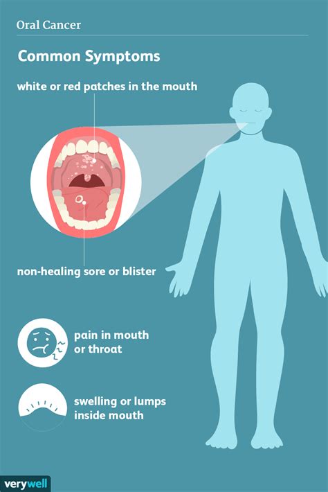 What are 5 signs of oral cancer?