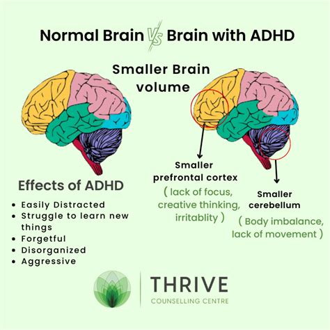 What are ADHD thoughts in the head?