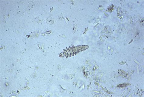 What are Demodex mites in hamsters?