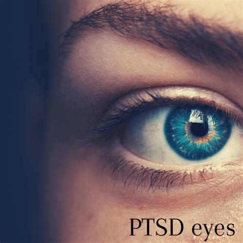 What are PTSD eyes?