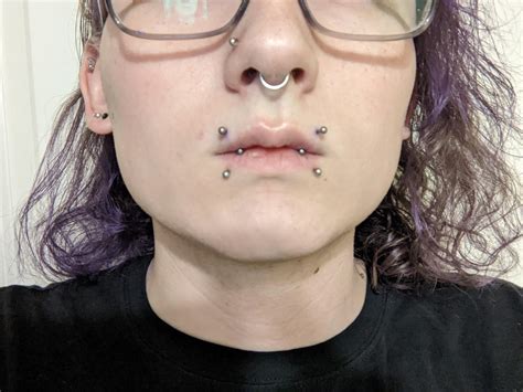 What are angel bites piercings?