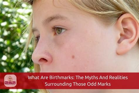 What are birthmarks myths?