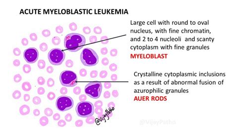 What are red flags of leukemia?