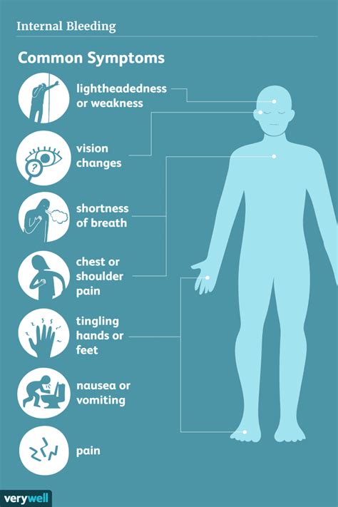 What are signs of internal bleeding?