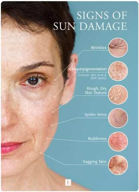 What are signs of sun damage?