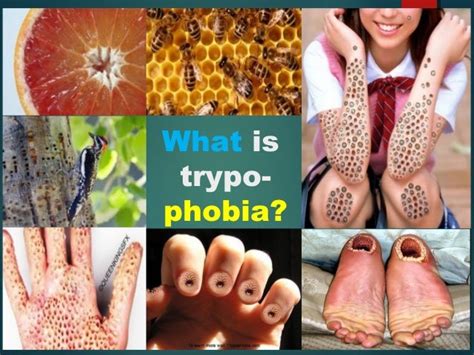 What are some interesting facts about trypophobia?