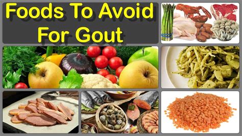 What are the 10 foods that trigger gout?