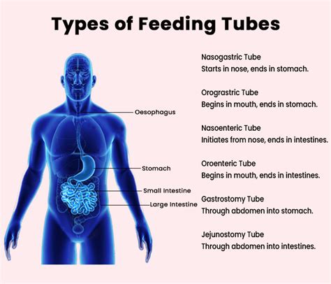What are the 3 commonly used types of enteral tubes?