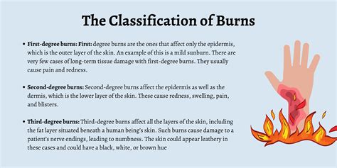 What are the 4 C's of burns?